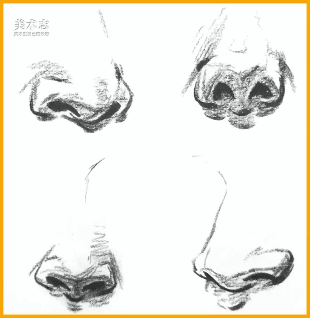 肌肉平衡重建矫正鼻部对称性的短期临床效果评估