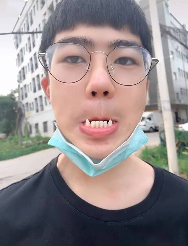 妈妈吐槽儿子像"吸血鬼",晒出儿子露牙照片后,众人深信不疑