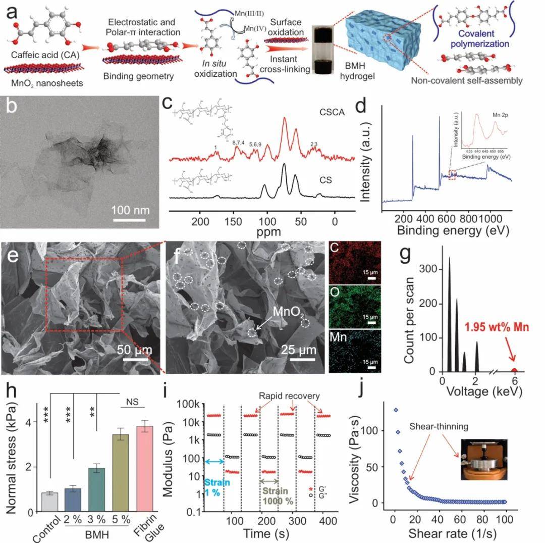 多响应MnO2复合水凝胶用于同时治疗黑色素瘤和耐药菌感染皮肤损伤修复-搜狐大视野-搜狐新闻