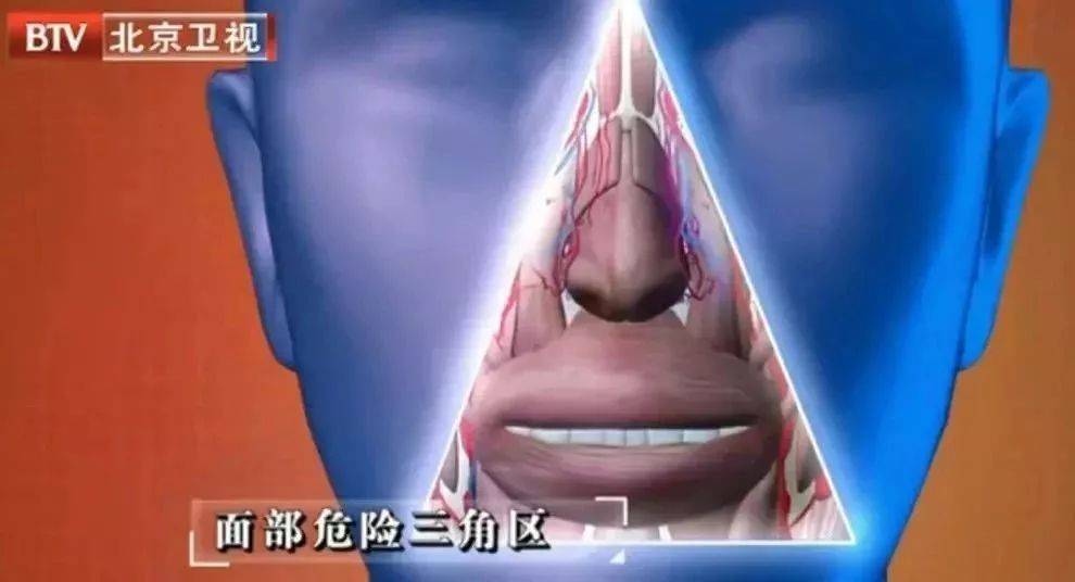 三角区就是医学里的"危险三角区,是指鼻下口周这一部位,也就是鼻翼