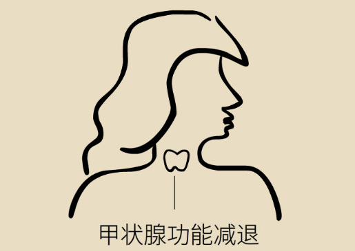 甲减影响寿命吗?警惕甲减诱发的四种疾病