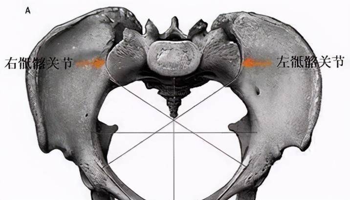 骶髂关节紊乱导致的长短腿:骶髂关节是由骶骨和髂骨的耳状关节面相对