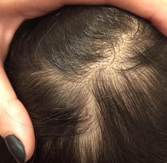 而且孩子害怕自己的妈妈也被这样扎,孩子还自己打自己,嘴里念叨着让你