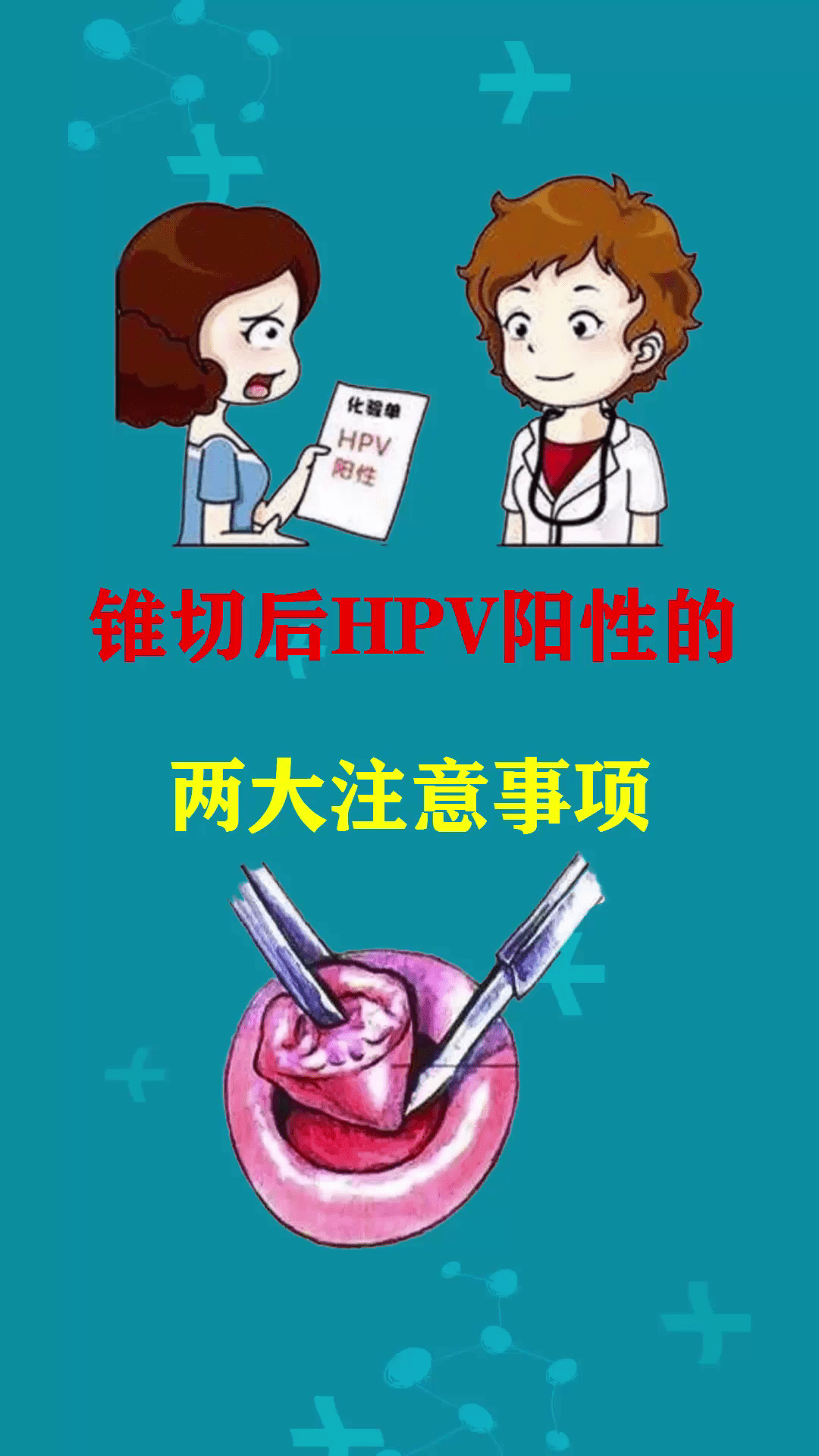 [项目展示]规范化子宫颈锥切术（LEEPCKC）和随访管理的应用 中国民族卫生协会培训部