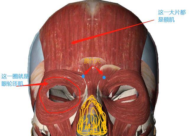 這個解剖也很簡單,針體穿過皮膚,淺筋膜刺入眼輪匝肌與額肌之間.