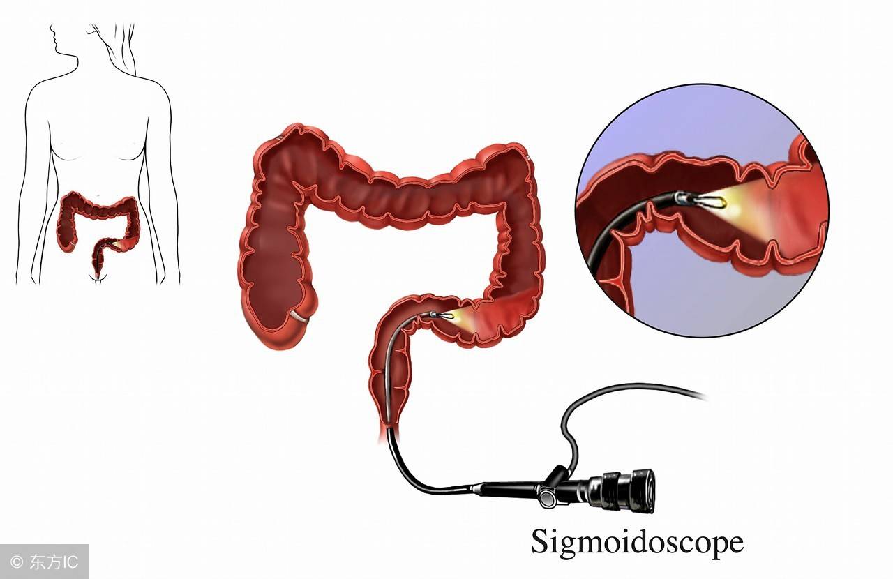 肛镜检查流程图片