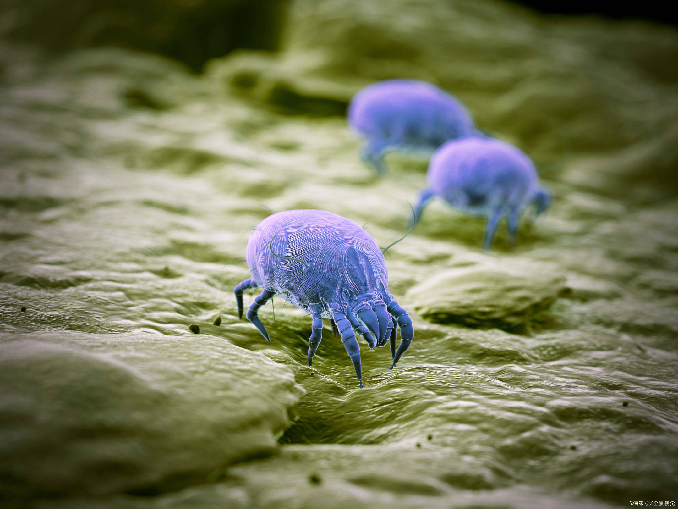 一般头上有螨虫的人,往往都会有以下几种现象,你可别不在意!_头发