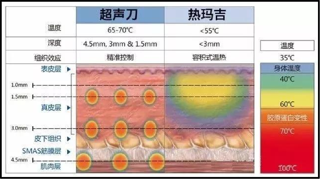 科普| 超聲刀與熱瑪吉