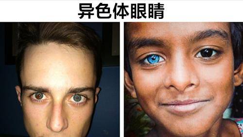 原创真实存在于世上拥有8种极其罕见眼睛颜色的人类