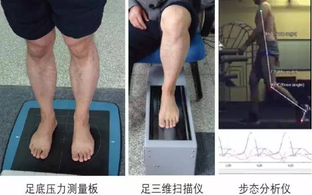 高弓足的病因及矫正方法