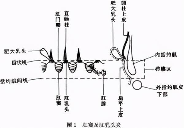 吃的不对?小心"小屁屁"造反,引发肛窦炎