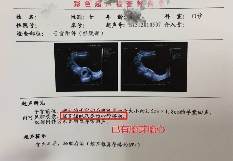 怀孕预产期计算器表便民服务网_孕妇预产期计算器_孕产妇预产期计算器