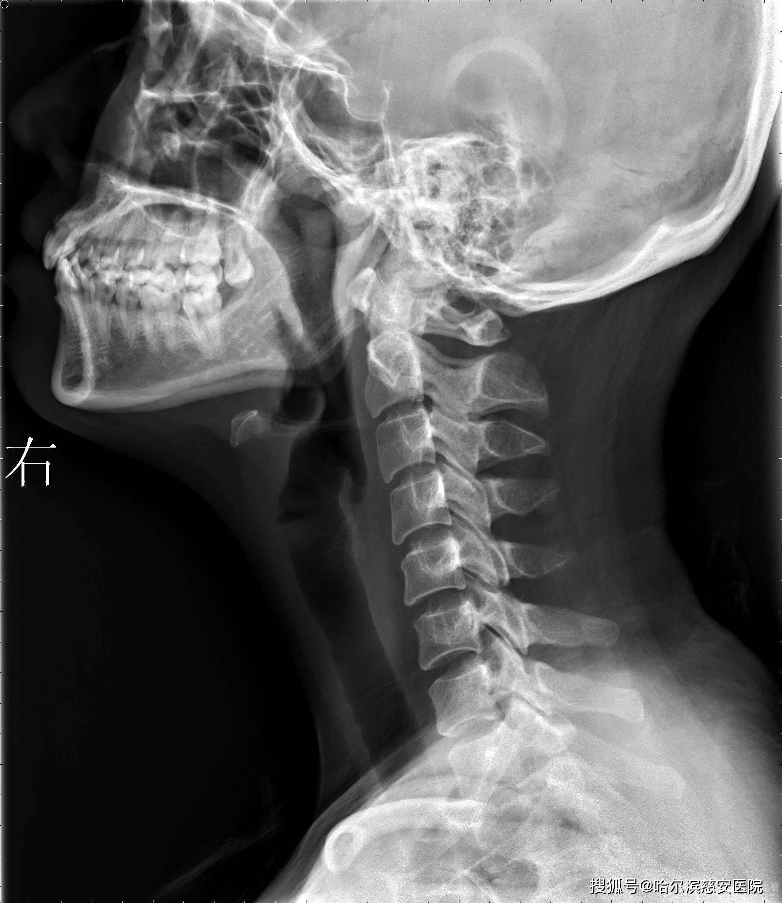 哈尔滨慈安医院乐大医学慈安医院