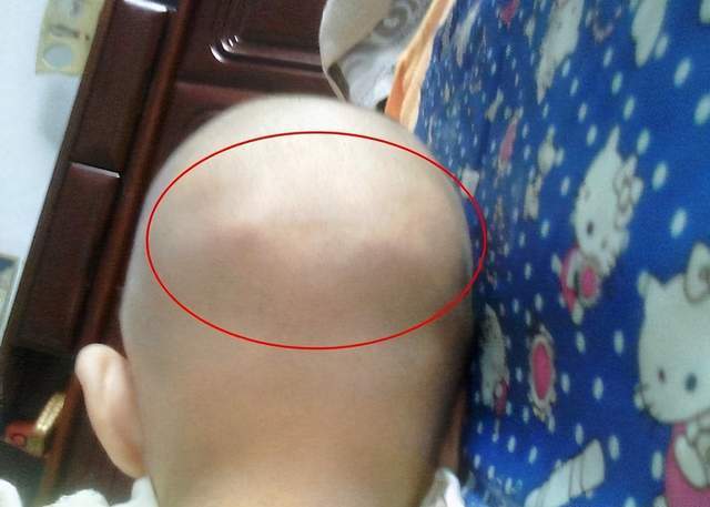 习惯等方面影响,不同的宝宝,头型是不太一样的,有些是圆头,有些是尖头