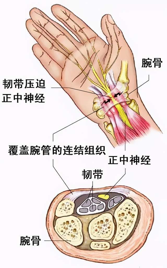 腕管结构图片