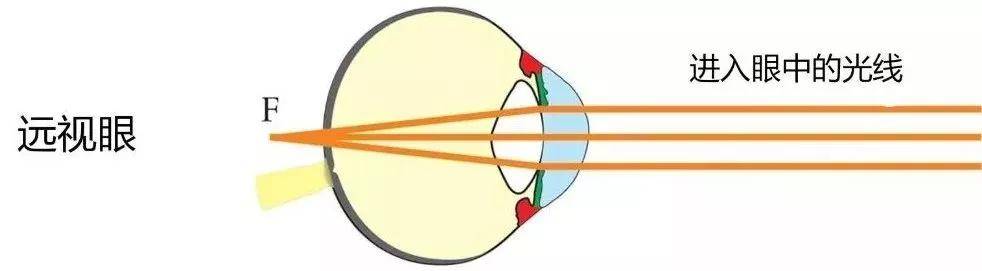 遠處的物體成像在視網膜後面,我們也是看不清的,這是我們常說的遠視