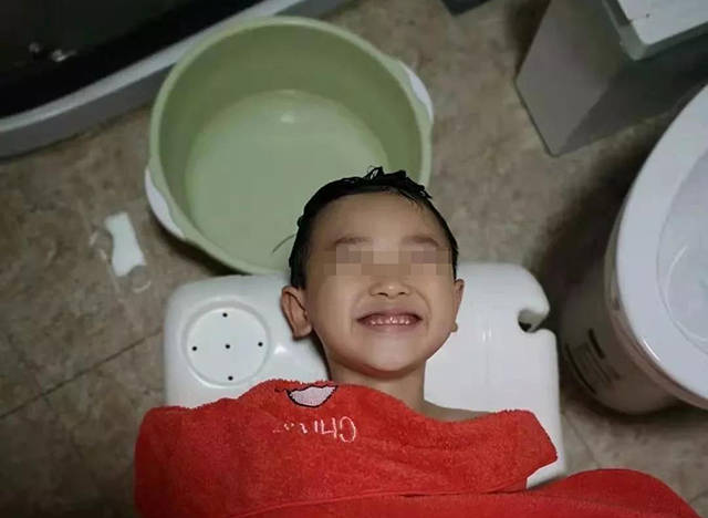 有的妈妈出于卫生考虑,每天都给孩子洗头,觉得这样的话孩子的头发会很