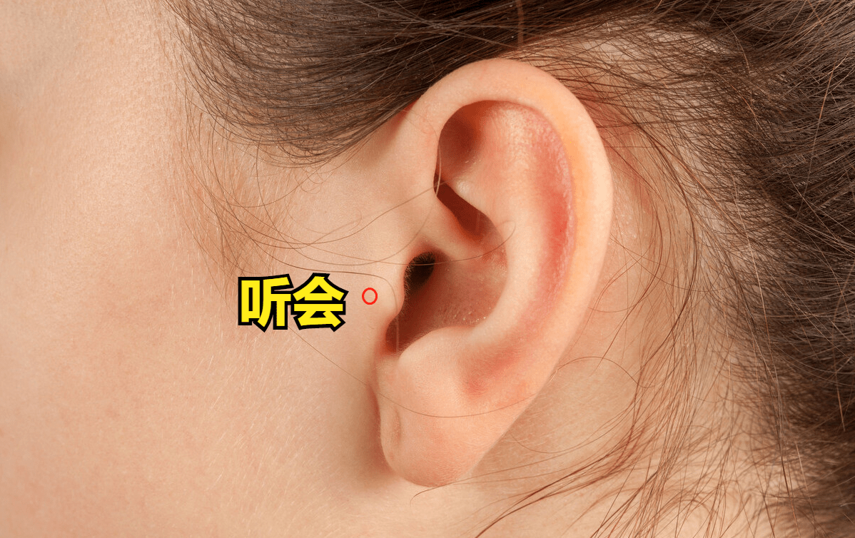 耳门,听宫,听会的位置图片