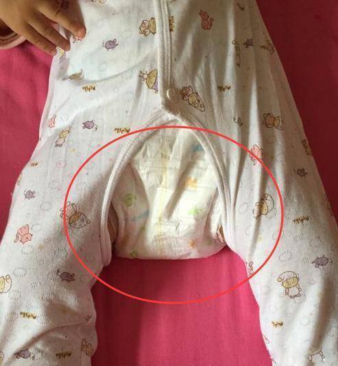 冬天想要孩子少生病,这衣服要少穿
