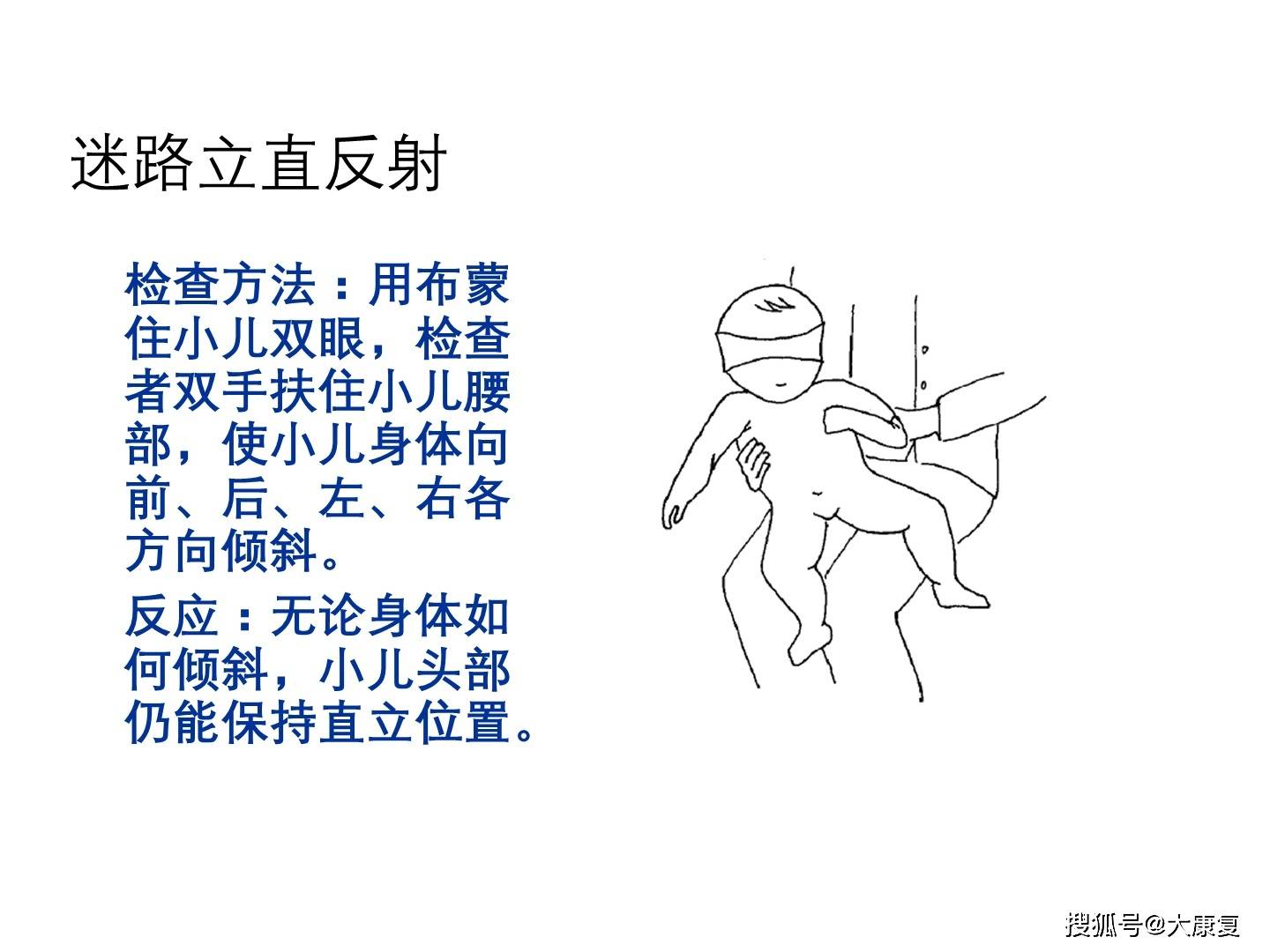 原始反射及肌张力判定