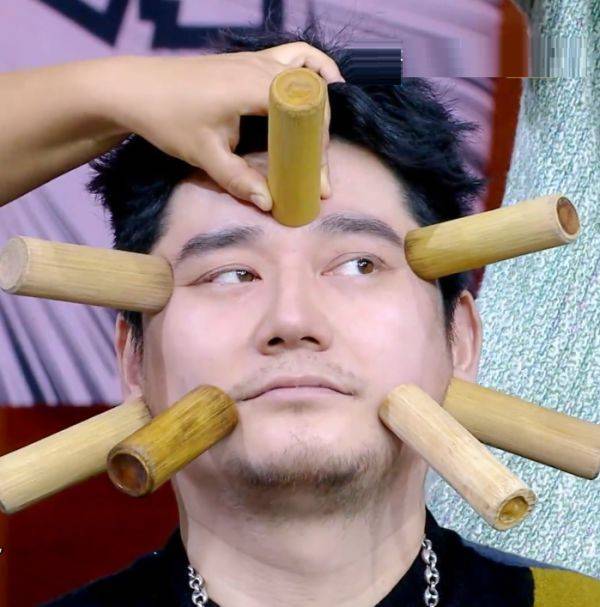 明星拔罐位置,王一博拔手心,大张伟选脖子,赵露思霸气