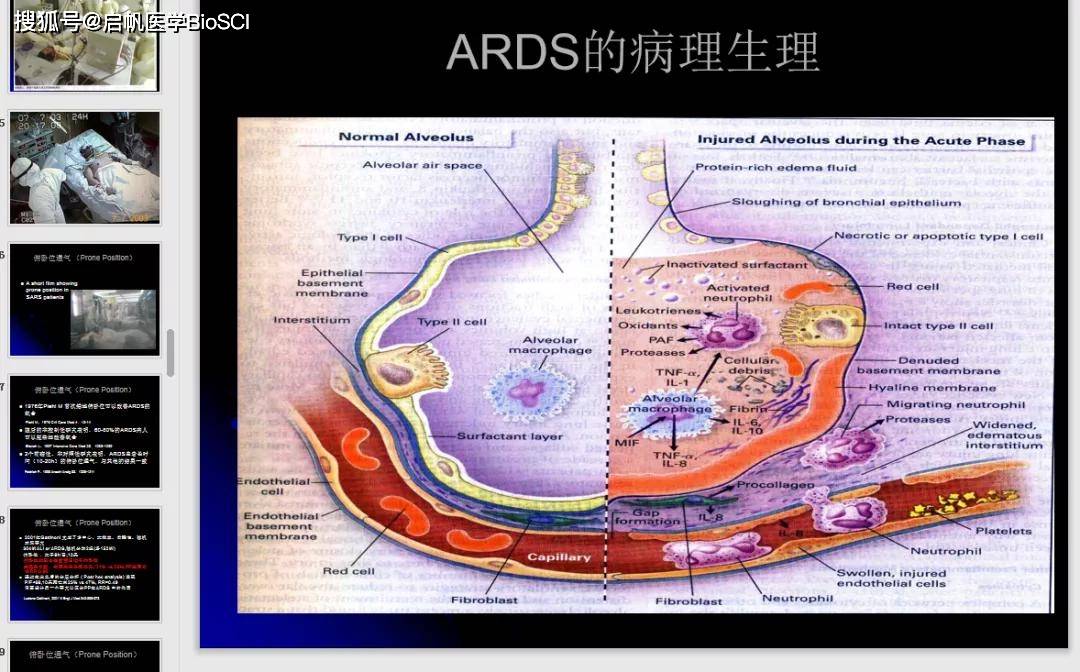 icu的建设和管理,opcab麻醉合理,多发性硬化,多模式镇痛与及通安