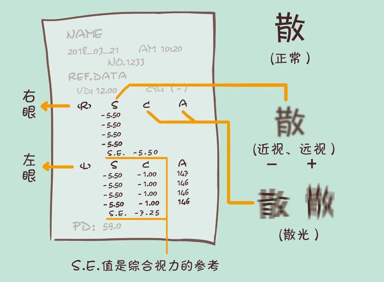 三分钟教你破译验光单上的奥秘