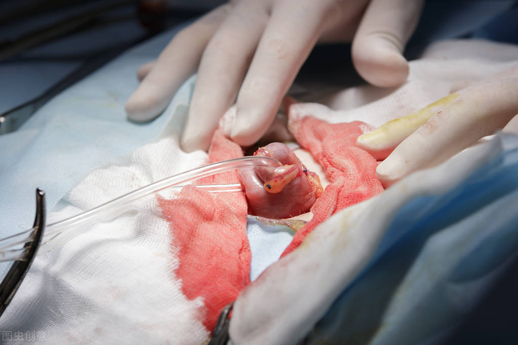 陈长怀医生80多岁肠癌患者,坚持中医治疗,我却建议他去手术,原因有这4