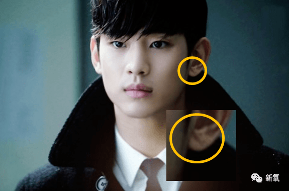 还有因心梗去世的高以翔,他的耳朵上有这个褶皱.