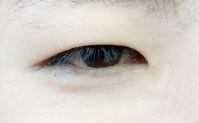 其实单眼皮的最大的bug就是眼皮浮肿让人觉得松弛,没精神.