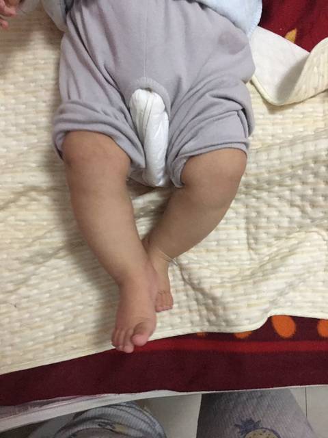 宝宝腿型发育图片