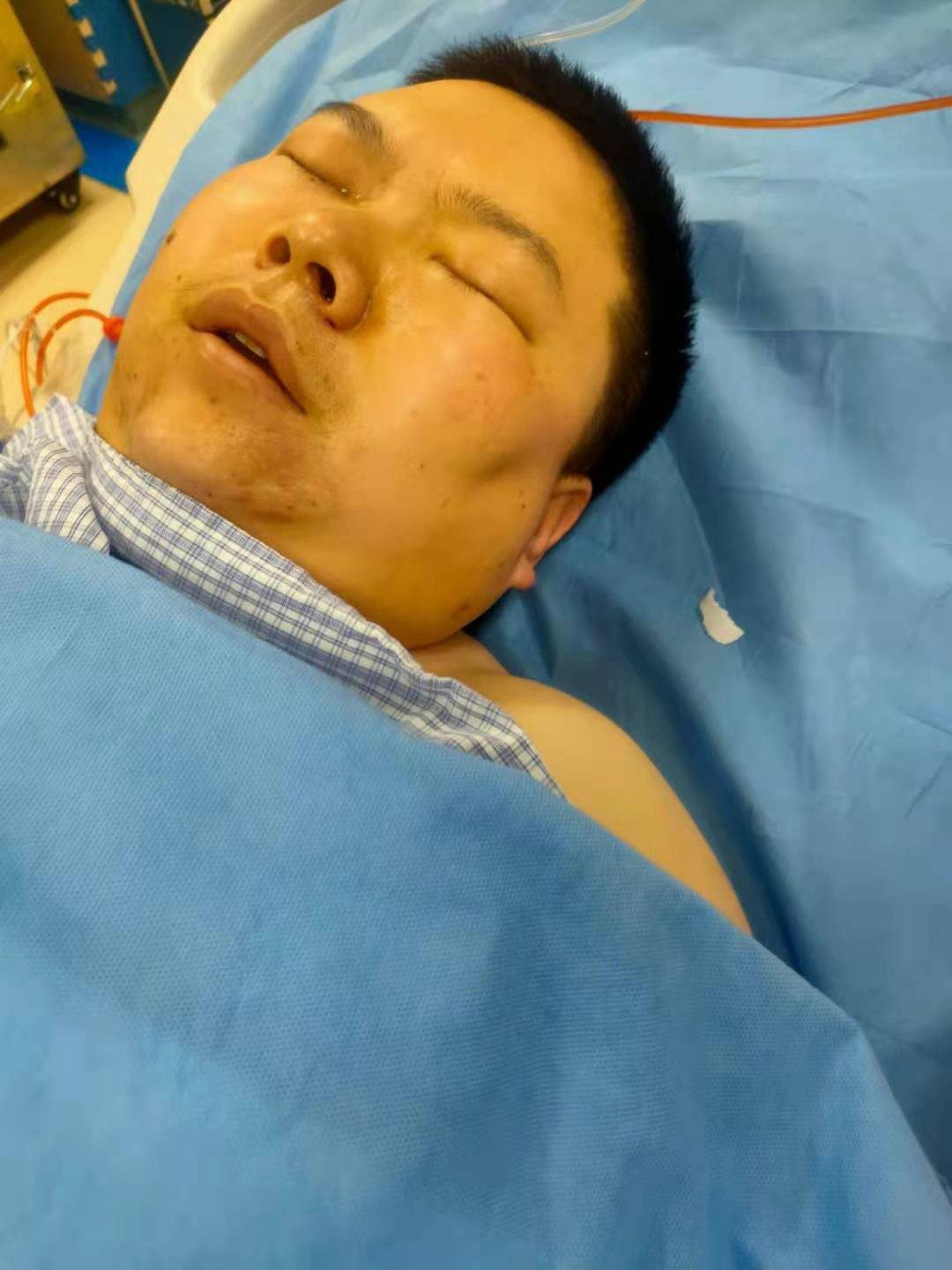 老公突患心脏主动脉夹层家中顶梁柱突然倒下了六个月