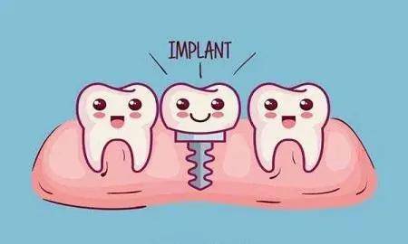 种牙一般可以使用多长时间 2e842f1ccbd84728b2715461a9de1532.jpeg