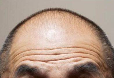 看看你有这种额头纹吗?有了必定是一生好命,富贵有加_三条