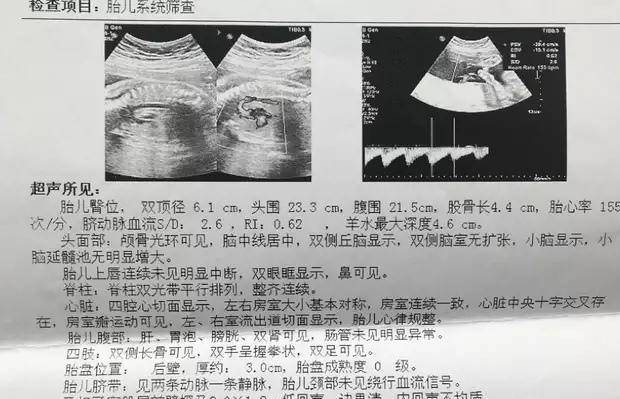 孕婦排畸檢查做三維彩超好還是四維彩超好看完就不會糾結了