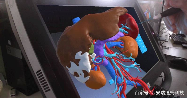 別再質疑vrmr裸眼3d技術在醫學臨床中的應用了