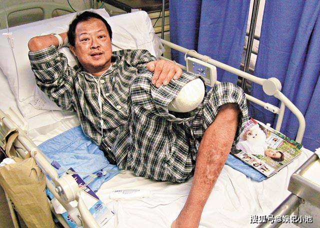 中年痛失双亲,晚年2次截肢,临终捐完财产,他用一生诠释了大爱无私