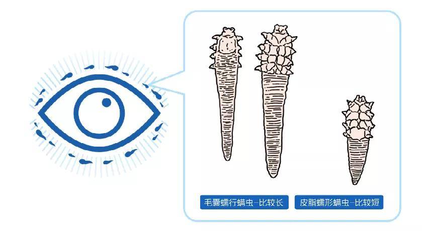 b031e51d59284b14a022404b9b3401ee.jpeg
