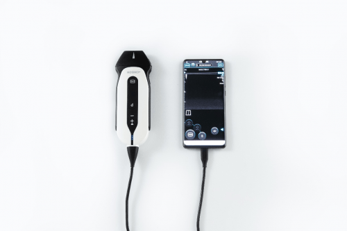 技术|医疗正式进入5G时代，祥生医疗已掌握超声仪器的“核心技术”！