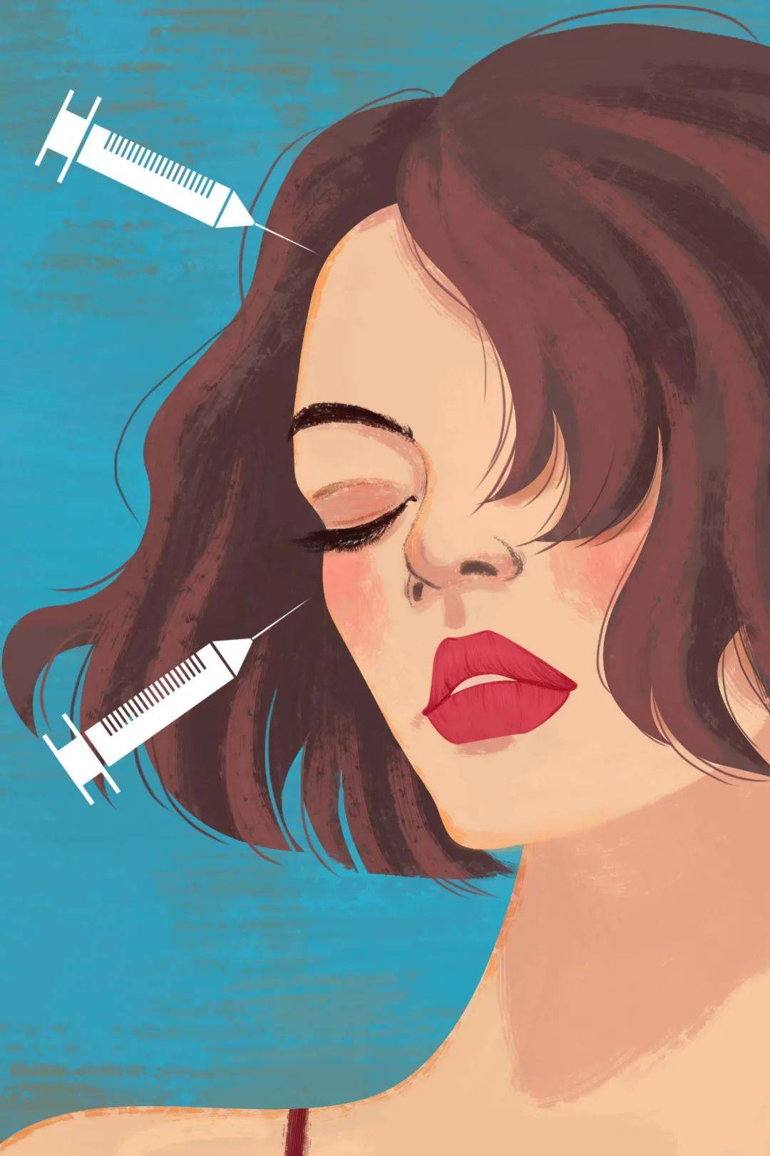 面部填充物注射治疗后可以打新冠疫苗吗