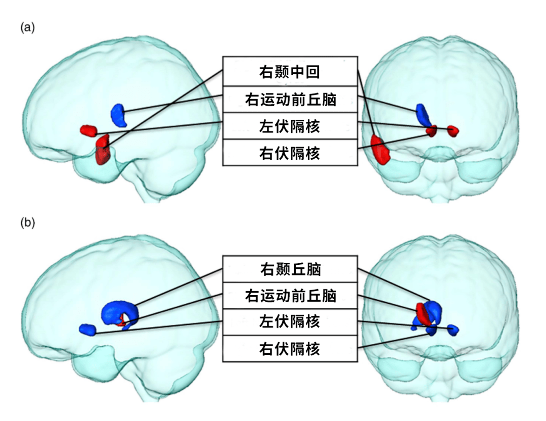 a 组为投喂薯片的小组,伏隔核活跃而具有负相关的区域则以蓝色突出