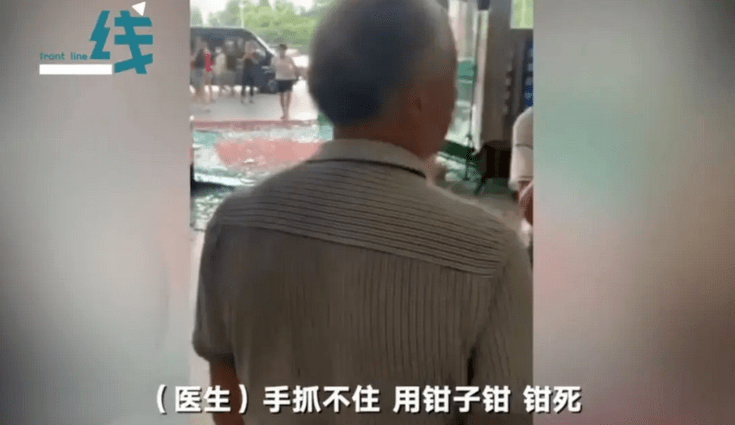 原来的镊子有多可怕?镊子真的有害吗?