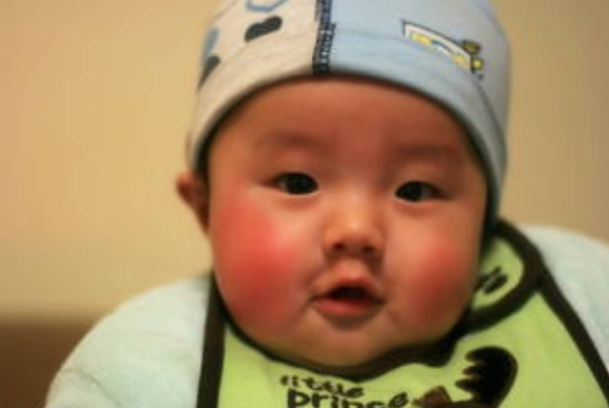红脸蛋 的宝宝很可爱 皮肤冻伤不容忽视 护理好才能白里泛红 家长