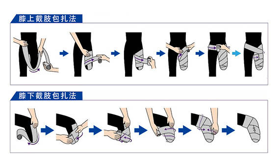 截肢后残肢头包扎图片图片