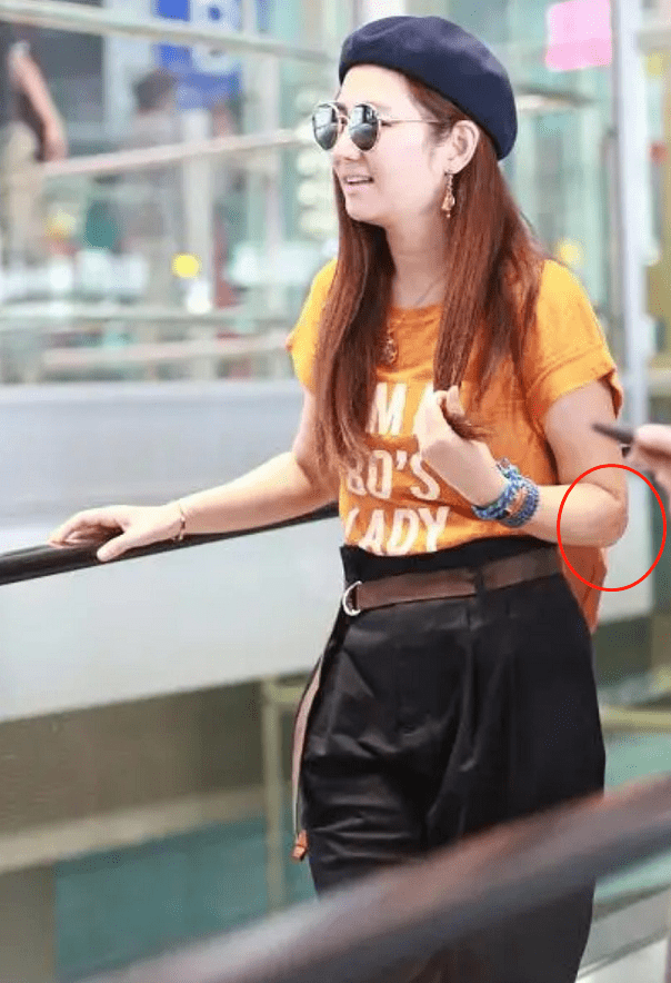 38岁任家萱露面,身材臃肿伤疤明显,拍戏被毁容后曾被老公说恶心_生活