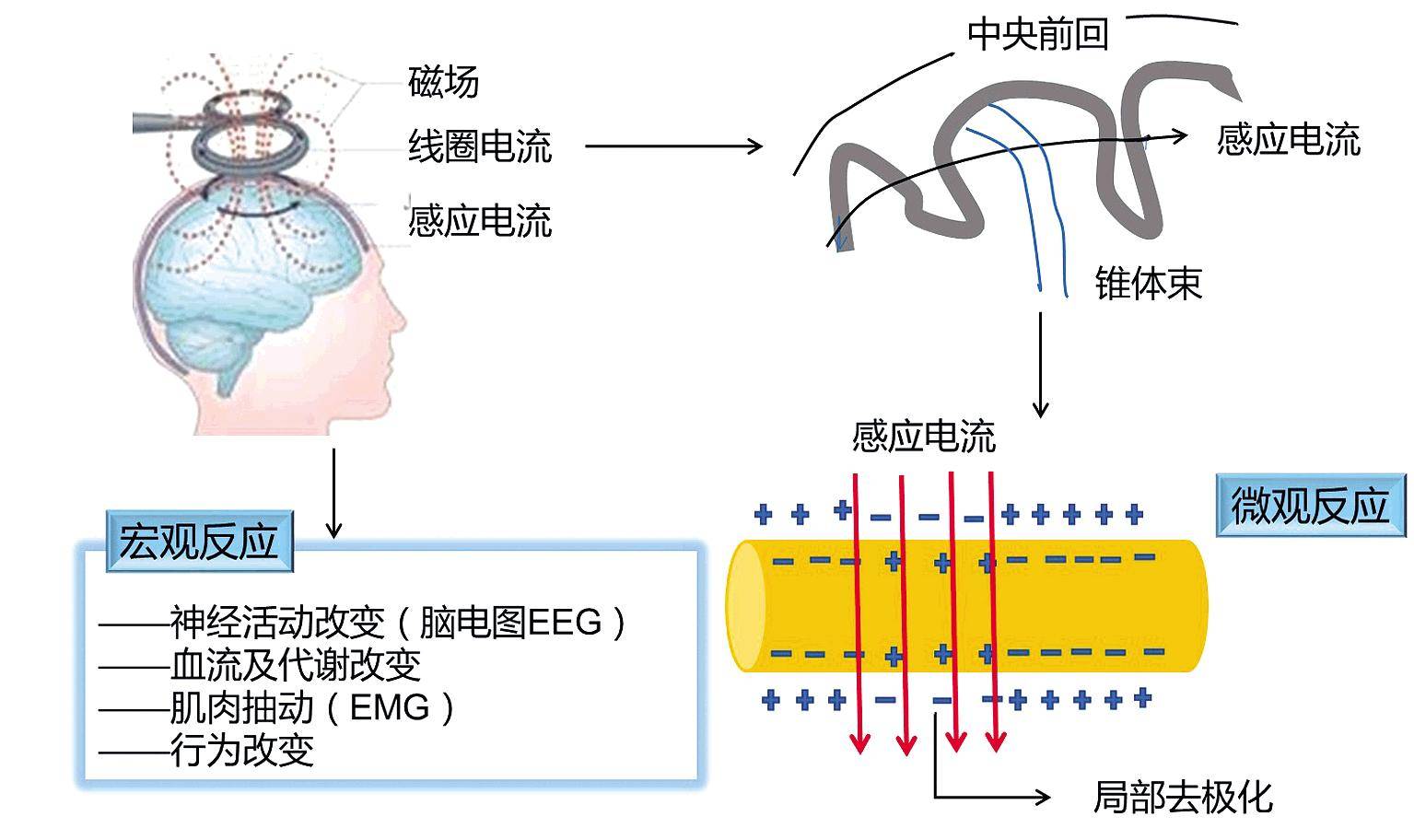 耳后止痛贴是什么原理_钱是万能止痛贴图片(3)