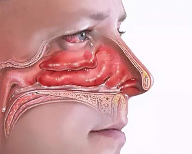 一躺下就鼻塞鼻塞跟体位有什么关系吗