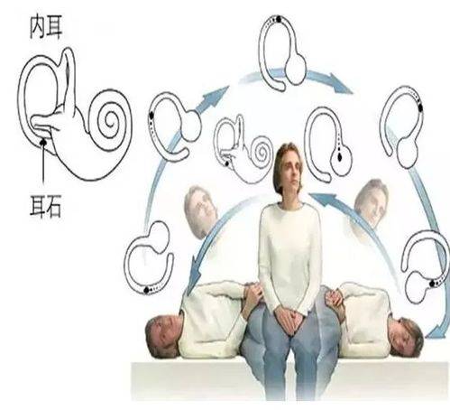 贵阳铭仁耳鼻喉医院警惕耳石眩晕症不致命但要命
