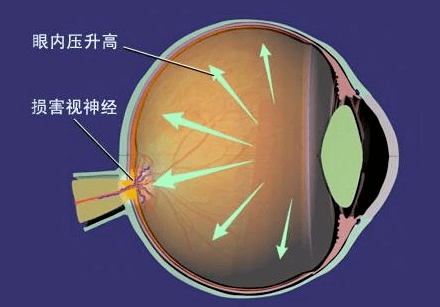 2725db20d4e8482d87ecdccf38ab4d61.png