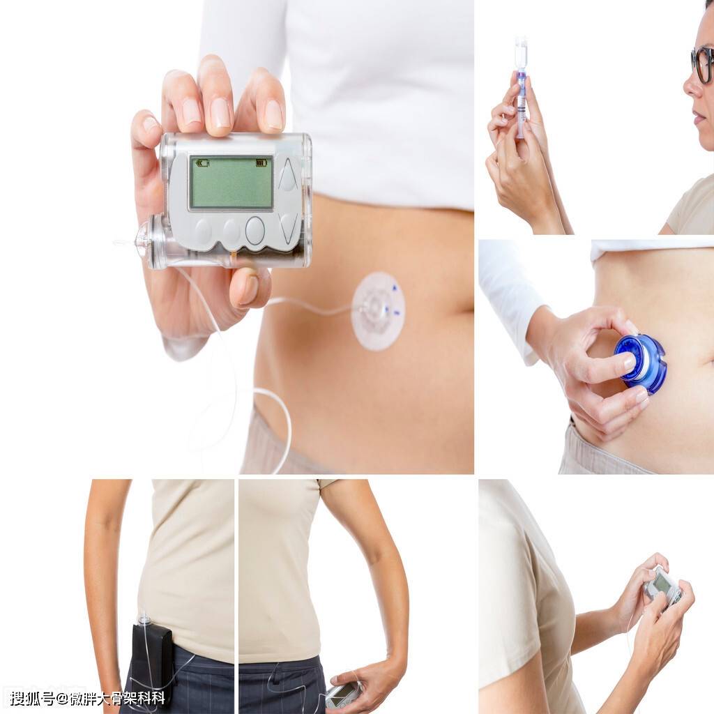 胰岛素是什么食物产生 c74605db547045fd852e09ac9eef40c7.jpeg